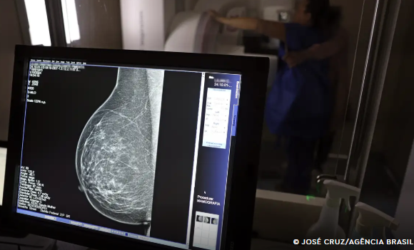 Ministério da Saúde passa a recomendar mamografia a partir dos 40 anos