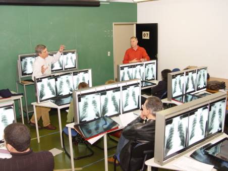 Leitura Radiológica de Pneumoconioses terá proposta de normatização